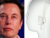 Сверхспособности и контроль. Что означают последние разработки Илона Маска в области чипизации мозга