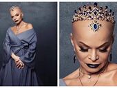 "Так ты лысая?". Фанаты в ужасе от головы Ларисы Долиной