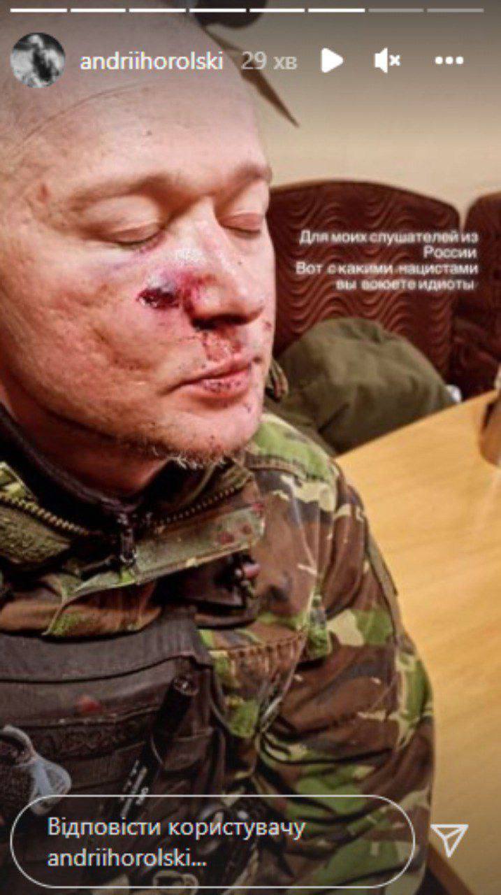 Хлывнюк попал под обстрел подробности